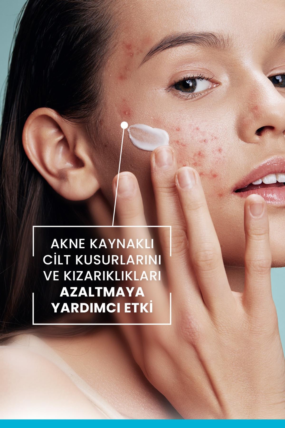 Ducray Keracnyl PP+ Krem Yağlı ve Akneye Eğilimli Ciltler İçin Bakım Kremi 30ml - 8